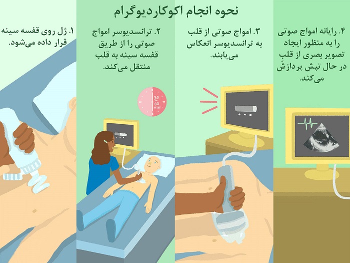 نحوه انجام اکوکاردیوگرام